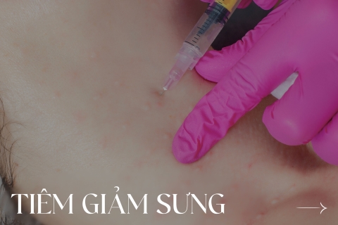 Tiêm Giảm Sưng